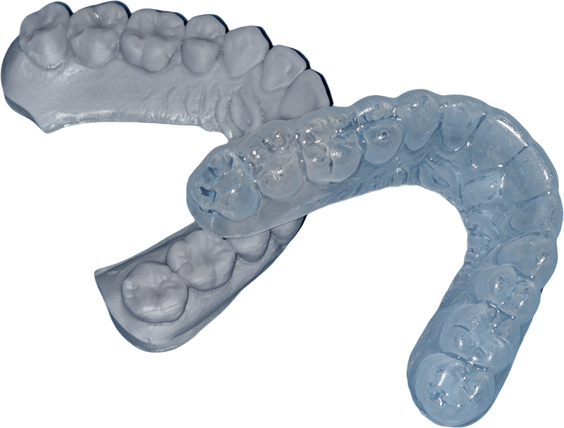 COMBO Placa Clareamento Dental + Escaneamento IO + Impressão de Modelos