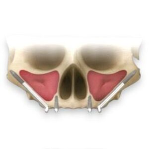 _cartpanda_151819775_cartpanda_151819949_cartpanda_162135839